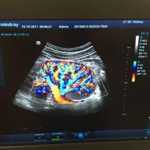 MINDRAY DC-8 OB / GYN - Vascular Ultrasound