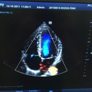 MINDRAY DC-8 OB / GYN - Vascular Ultrasound