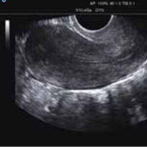 MINDRAY M7 Shared Service Ultrasound