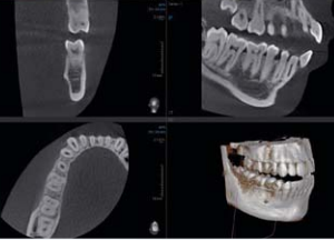 Vatech PaX Duo 2D 3D CBCT Pan FOV 12x8.5 مع الكمبيوتر الشخصي، ضمان