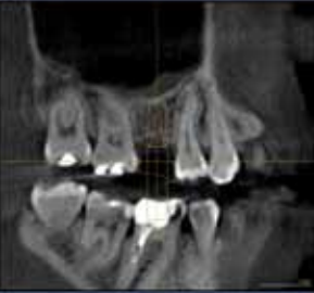 Sirona Galileos Comfort 3D CBCT 15x15 FOV mit PC, Garantie