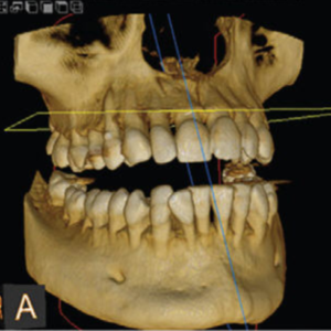 ICAT Next Gen 2D 3D CBCT Pan, 23x17 FOV avec PC, Garantie