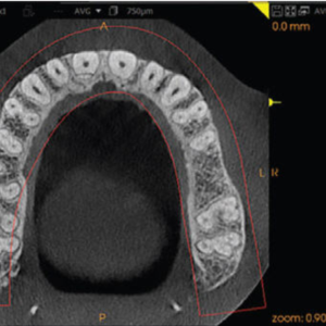 ICAT Next Gen 2D 3D CBCT Pan, 23x17 FOV avec PC, Garantie