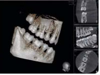 Vatech PaX Duo 2D+3D+CBCT Pan FOV 12x8.5 mit PC, Garantie