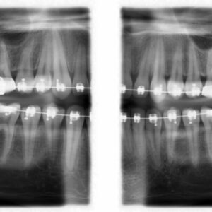 Planmeca ProMax Mid 2D 3D CBCT Pan 20 x 17 FOV (900 تعريض) مع الضمان