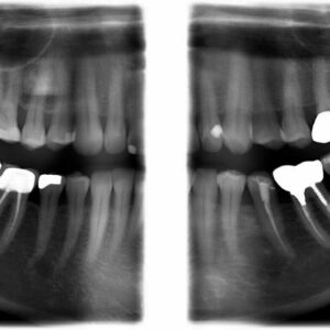 Planmeca ProMax Mid 2D 3D CBCT Pan 20 x 17 FOV (900 Belichtungen) mit Garantie