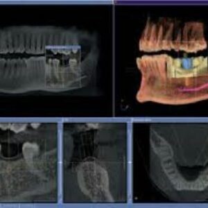 Sirona XG 2D 3D CBCT 8x8 FOV mit PC, Garantie