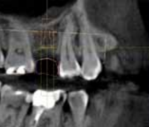 Sirona Galileos Comfort 3D CBCT 15x15 FOV mit PC, Garantie