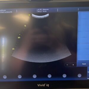 GE 4C-RS Ultrasound Probe
