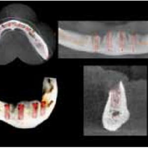 Carestream CS9000 2D+3D+CBCT FOV 5x5 Pan+Ceph mit PC, Garantie