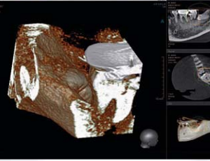 Vatech PaX Duo 2D 3D CBCT Pan FOV 12x8.5 avec PC, Garantie