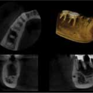 Carestream CS9000 2D 3D CBCT FOV 5x5 Pan Ceph con PC, Garantía