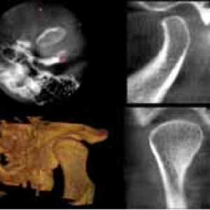 Carestream CS9000 2D 3D CBCT FOV 5x5 Pan Ceph مع الكمبيوتر الشخصي، الضمان