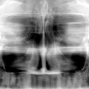 Carestream CS9000 2D+3D+CBCT FOV 5x5 Pan+Ceph mit PC, Garantie