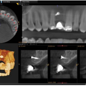 Carestream CS9000 2D 3D CBCT FOV 5x5 Pan Ceph مع الكمبيوتر الشخصي، الضمان