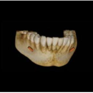 Carestream CS9000 2D 3D CBCT FOV 5x5 Pan Ceph مع الكمبيوتر الشخصي، الضمان