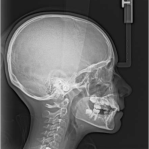 Carestream CS9000 2D 3D CBCT FOV 5x5 Pan Ceph مع الكمبيوتر الشخصي، الضمان