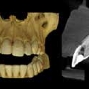 Carestream CS8100 2D 3D CBCT Pan 8x9 FOV مع الكمبيوتر الشخصي، ضمان