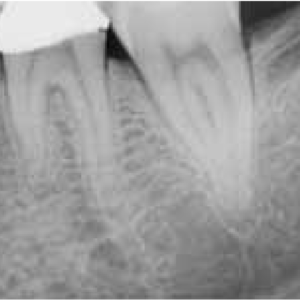 Carestream CS9000 2D 3D CBCT Pan مع الكمبيوتر الشخصي والبرمجيات والضمان