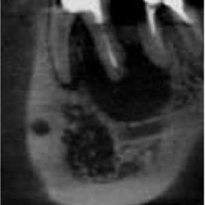 Carestream CS9000 2D 3D CBCT Pan con PC, Software, Garantía