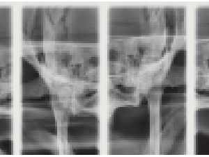 Sirona XG 2D 3D CBCT 8x8 FOV con PC, Garantía