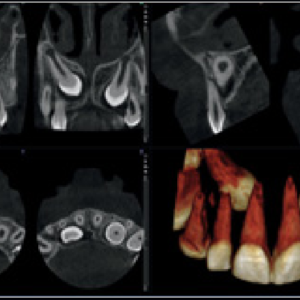 Planmeca ProMax Mid 2D 3D CBCT Pan 20 x 17 FOV (900 exposiciones) con garantía