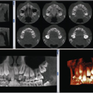 Planmeca ProMax Mid 2D 3D CBCT Pan 20 x 17 FOV (900 exposiciones) con garantía