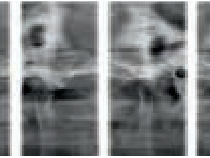 Sirona XG 2D 3D CBCT 8x8 FOV avec PC, Garantie