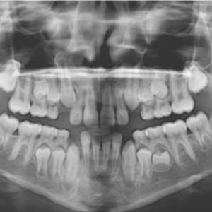 Carestream CS9000 2D 3D CBCT Pan مع الكمبيوتر الشخصي والبرمجيات والضمان