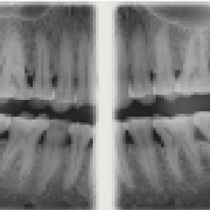 Sirona XG 2D 3D CBCT 8x8 FOV avec PC, Garantie