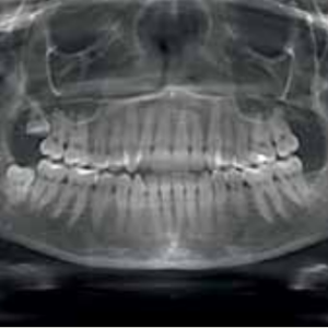 Sirona Galileos Comfort 3D CBCT 15x15 FOV avec PC, Garantie