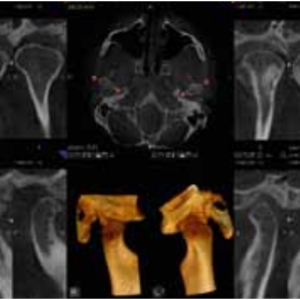 Carestream CS9300 Premium 2D 3D CBCT Pan 17x13,5 FOV mit Garantie