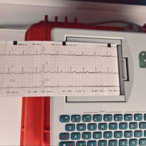 Refurbished SCHILLER Cardiovit AT-101