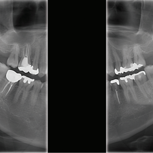 J. Morita Veraviewepocs X-550 R100 2D+3D+CBCT Pan 10x8 FOV mit Garantie