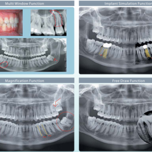 Vatech PaX Duo 2D 3D CBCT Pan FOV 12x8.5 con PC, Garantía