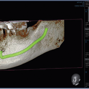 Vatech PaX Duo Plus 2D 3D CBCT Pan FOV 12x8.5 مع الكمبيوتر الشخصي، ضمان