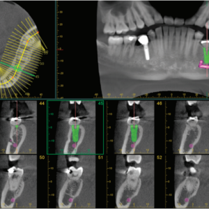 J. Morita Veraviewepocs X-550 R100 2D 3D CBCT Pan 10x8 FOV mit Garantie