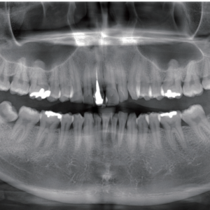 J. Morita Veraviewepocs X-550 R100 2D 3D CBCT Pan 10x8 FOV con garantía