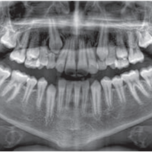 NouveauTom Giano HR Prime 2D 3D CBCT Pan 10x8 FOV avec Garantie