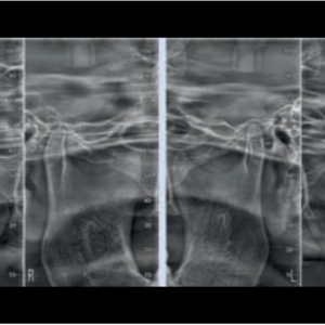 NewTom Giano HR Prime 2D 3D CBCT Pan 10x8 FOV mit Garantie