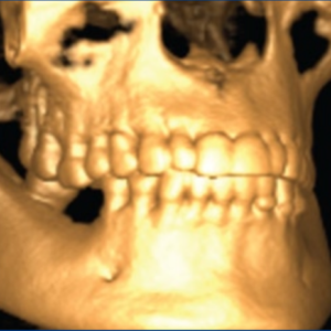 Gendex (iCAT) CB-500 2D 3D CBCT Pan 14x8 FOV مع الكمبيوتر الشخصي، ضمان