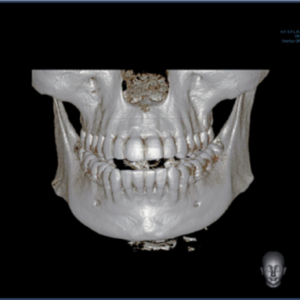 Vatech PaX Duo 2D 3D CBCT Pan FOV 12x8.5 avec PC, Garantie