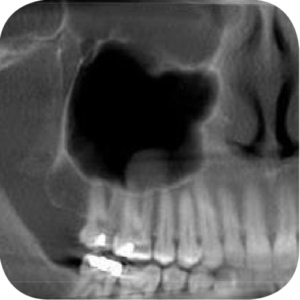 Gendex (iCAT) CB-500 2D+3D+CBCT Pan 14x8 FOV mit PC, Garantie