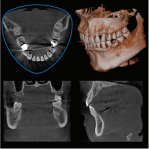 J. Morita Veraviewepocs X-550 R100 2D+3D+CBCT Pan 10x8 FOV mit Garantie