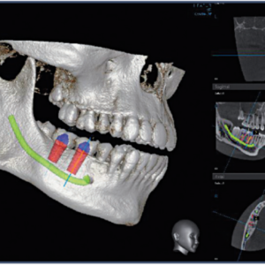 Vatech PaX Duo Plus 2D+3D+CBCT Pan FOV 12x8.5 mit PC, Garantie