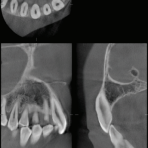 J. Morita Veraviewepocs X-550 R100 2D+3D+CBCT Pan 10x8 FOV mit Garantie