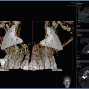 Vatech PaX Duo Plus 2D 3D CBCT Pan FOV 12x8.5 مع الكمبيوتر الشخصي، ضمان