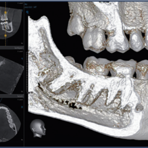 Vatech PaX Duo Plus 2D 3D CBCT Pan FOV 12x8.5 avec PC, Garantie