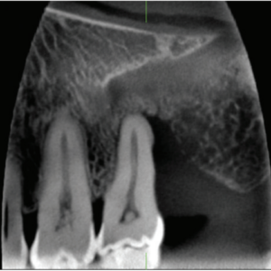 J. Morita Veraviewepocs X-550 R100 2D 3D CBCT Pan 10x8 FOV con garantía