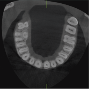 J. Morita Veraviewepocs X-550 R100 2D 3D CBCT Pan 10x8 FOV mit Garantie